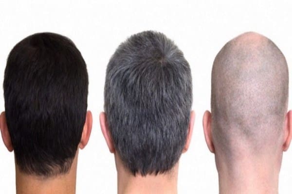 Foto: Rambut Berwarna