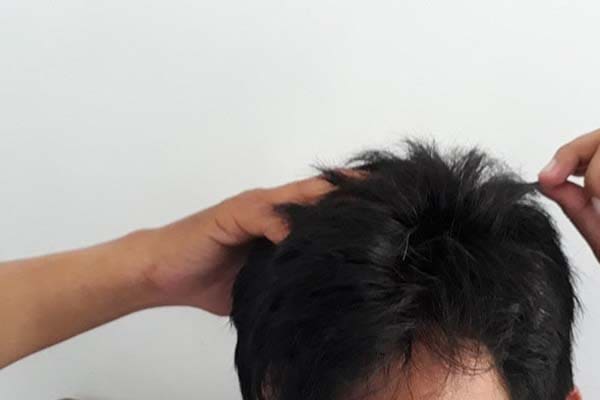 Apa Penyebab Tumbuhnya Uban? 3 Hukum Menjual Rambut, uban