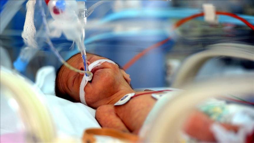 Laporan: Akibat Beban Biaya, Bayi Lahir Prematur di AS Meningkat 1