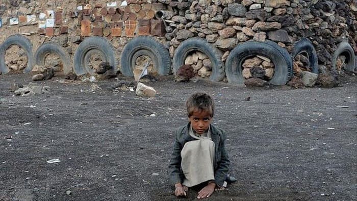 Anak Yaman terancam kelaparan. Foto: Anadolu