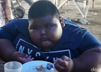 Satia Putra bocah obesitas di Karawang. Foto: Detik