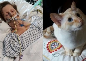 Seorang nenek nyaris meninggal akibat cakaran kucing. Foto: Yahoo