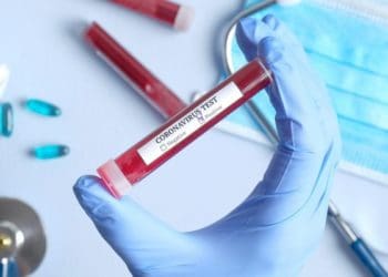 Ilustrasi. Foto: 
Chiamamicitta