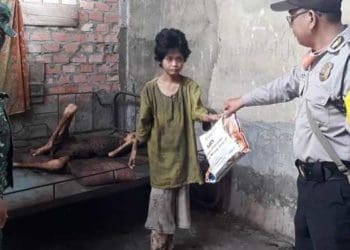 Dua warga berkebutuhan khusus ditemukan berbadan kurus kering di Sumsel. Foto: Detik
