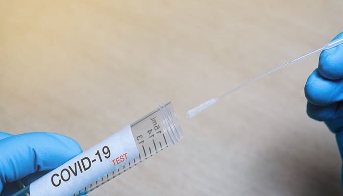 Menteri Kesehatan Ghana Positif Covid-19 1 Ilustrasi. Foto:
epmmagazine