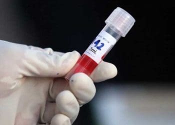 Virus Corona COVID-19. Foto: Detik/Agung Pambudhy