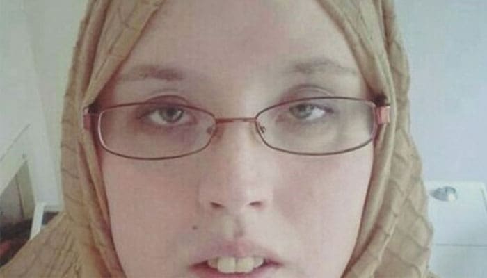 Komedo hitam, Penyebab Pengelupasan Kulit, Hukum Memakai Bulu Mata Palsu