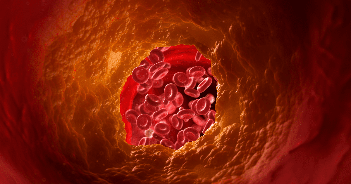 8 Dampak Buruk Makan Daging Sapi Secara Berlebihan 2 Dampak buruk makan daging sapi