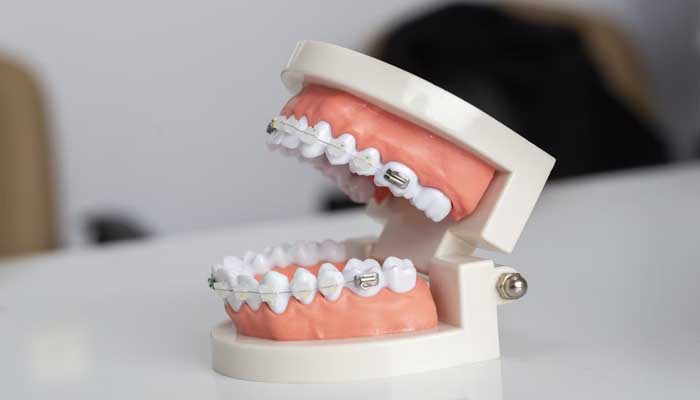 5 Cara Alami Obati Sariawan 1 mulut, lisan, sariawan