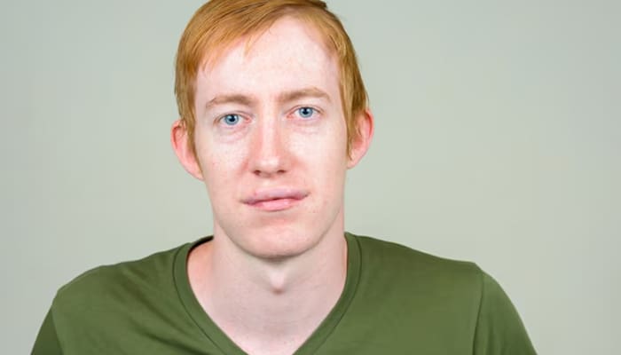 Kenapa Seseorang Bisa Terkena Diare? 1 Tanda Gula Darah Tinggi, Diare, Ciri Kolesterol Tinggi