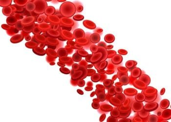 anemia