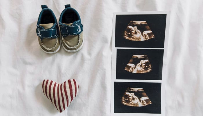 10 Mitos saat Kehamilan: Antara Kepercayaan dan Fakta Medis 1 kehamilan